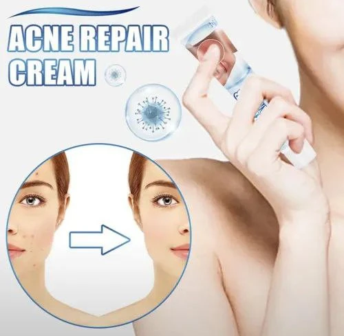 Крем от угрей Sumifun