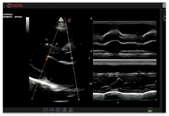 Esaote MyLab Omega ekspert sinfining portativ ultratovush tizimi