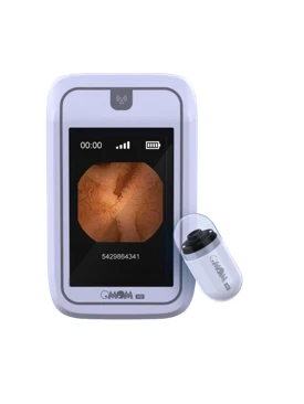 Kapsula endoskopiyasi