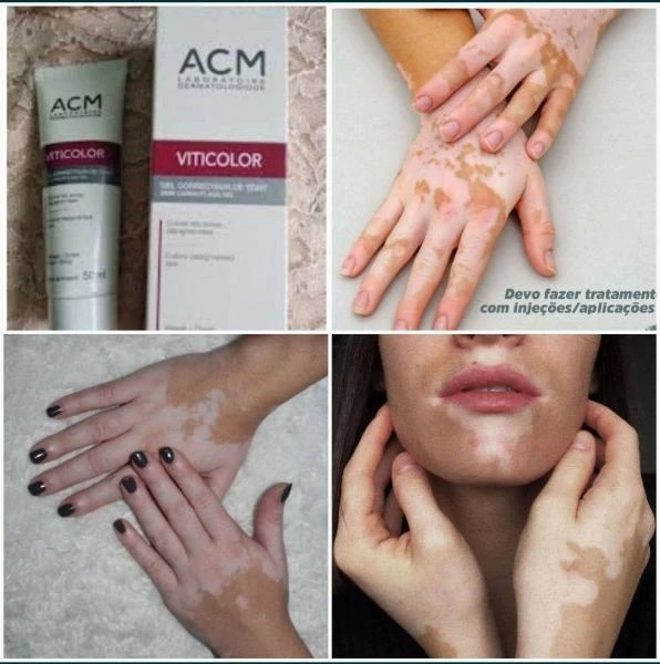 Viticolor oq dog'ni yopib turuvchi krem