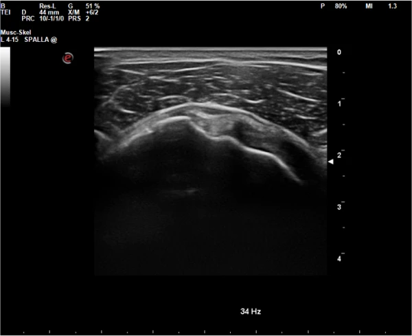 Esaote MyLab X5 ultratovush apparati