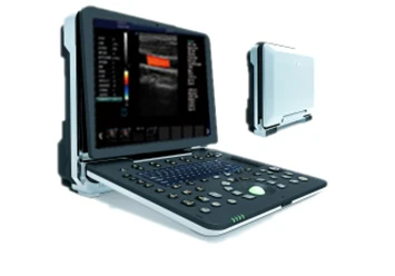 4D dopplerovskaya diagnosticheskaya sistema