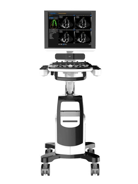 UZI - ULTRAZVUKOVAYA DIAGNOSTICHYeSKAYA SISTEMA CHISON QBIT 9
