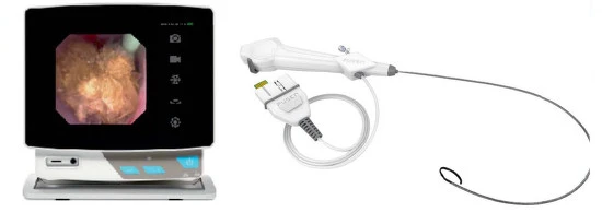 Цифровой гибкий уретерореноскоп с монитором