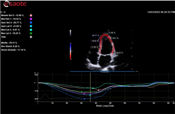 Esaote MyLab Omega ekspert sinfining portativ ultratovush tizimi