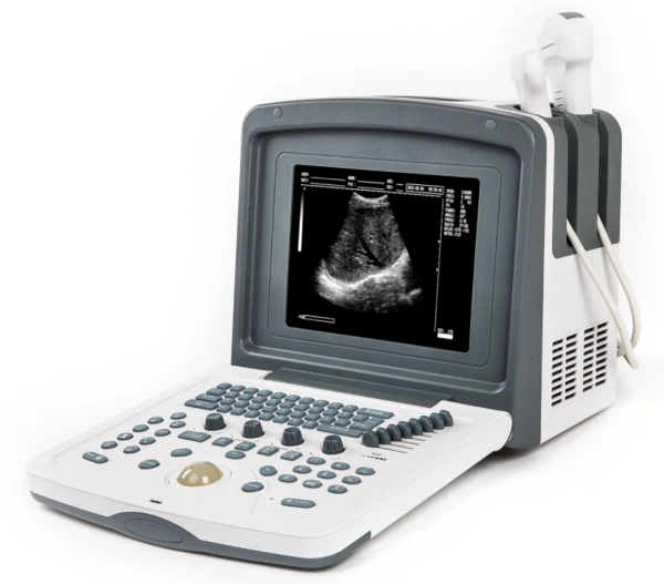 УЗД сканеры