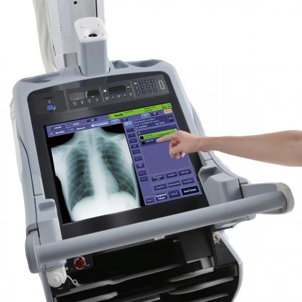 Mobilniy rentgenovskiy apparat Shimadzu MobileDArt Evolution (Yaponiya)