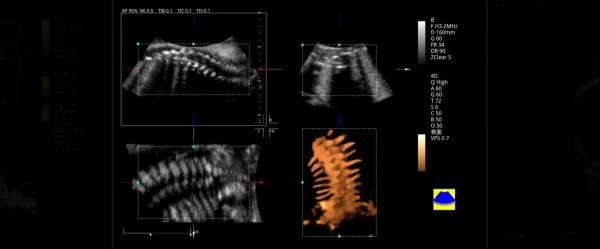 Ultrazvukovaya diagnosticheskaya oborudovanie ViV80