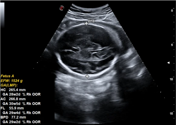 Ультразвуковой сканер Esaote MyLab X5