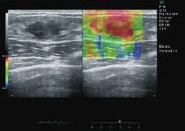 UZI apparat ZONCARE-Q7