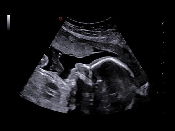 GE17-0230-01 SP-Сефадекс C-25,100 гтSP-SEPHADEX C-25, 100 G,