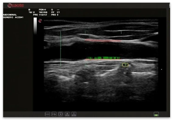 УЗИ аппарат экспертного класса Esaote MyLab X6
