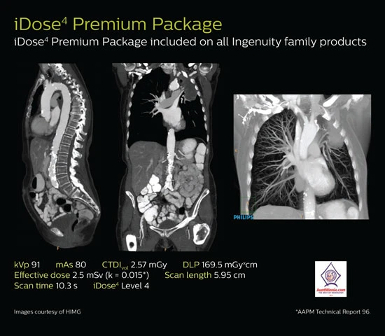 Компьютерный томограф Philips Ingenuity 64/128