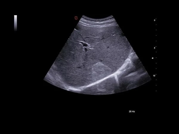 GE17-0230-01 SP-Сефадекс C-25,100 гтSP-SEPHADEX C-25, 100 G,
