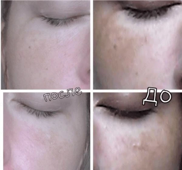 Отбеливающий крем для чувствительных зон Alаtar Collagen & Milk Quick Whitening