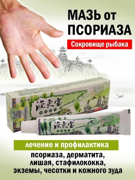 Psoriaz, dermatit, liken, qichishish uchun "baliqchining xazinasi" malhami