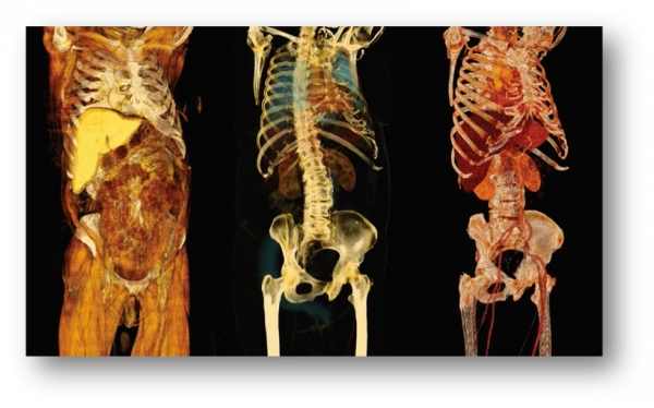 AnyScan Trio SPECT/CT/PET tizimi