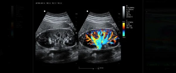 Ultrazvukovaya diagnosticheskaya oborudovanie ViV80