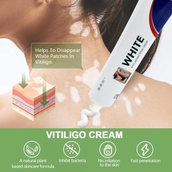 Крем антибактериальный против белых пятен витилиго