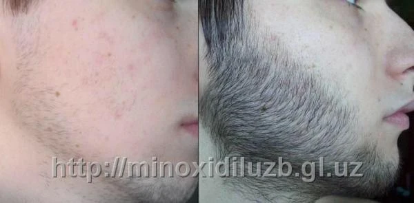 TOOTH PASTE 125 ml - Zubnaya pasta