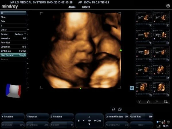 Система ультразвуковой диагностики  Модель: SonoScape S-40