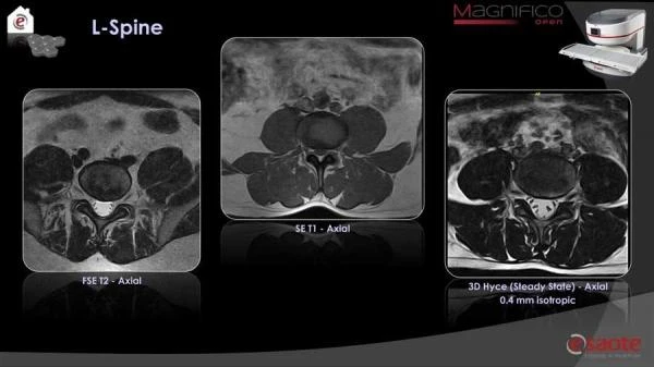 Magnifico yangi avlod MRI tizimi