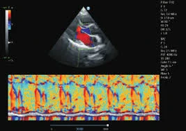 UZI apparat ZONCARE-Q7