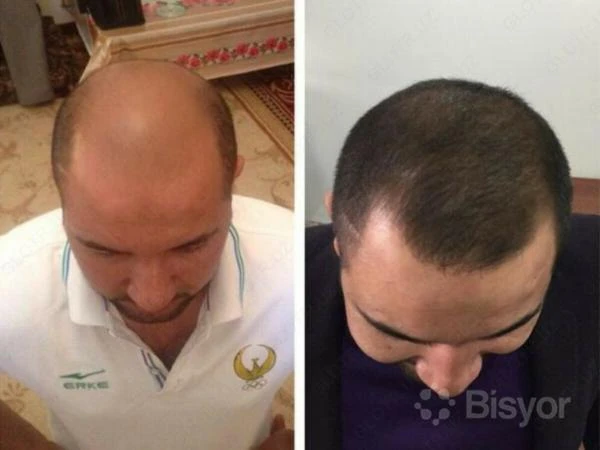 Масло для роста волос Nuzen gold