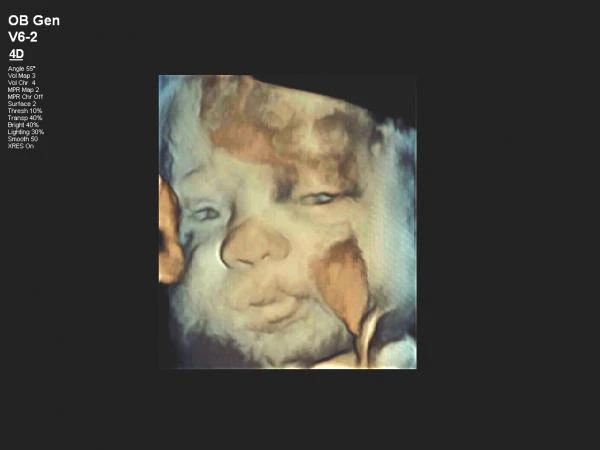 Ultratovushli tizim Philips Affiniti 30