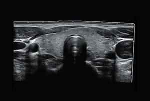Sistema ultrazvukovaya diagnostika Model: SonoScape P-9