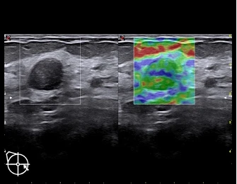 Esaote MyLab X75 universal ultratovush skaneri
