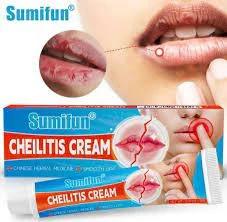 Vosstanavlivayushiy balzam dlya gub Sumifun Cheilitis 20 gr.