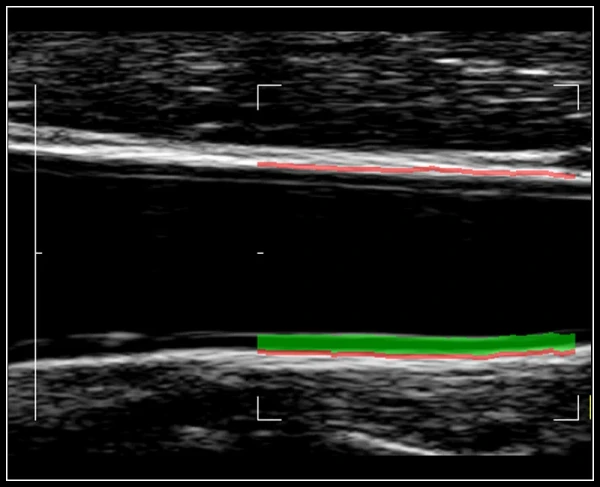 Ko'p funktsiyali ultratovushli tomograf Esaote MyLab 9 eXp