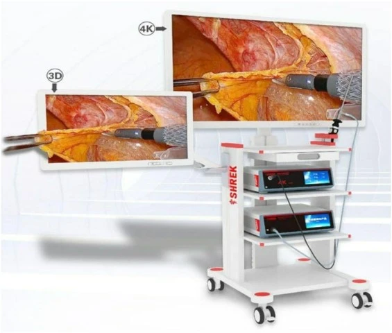 Эндоскоп Видео Эндоскопическая система Premium Classa
“SHREK” 4K format