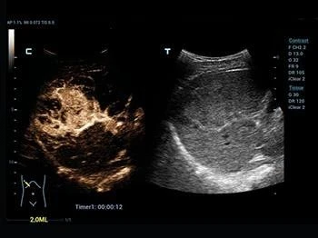 Sistema ultrazvukovoy diagnostiki  model: SonoScape-S50