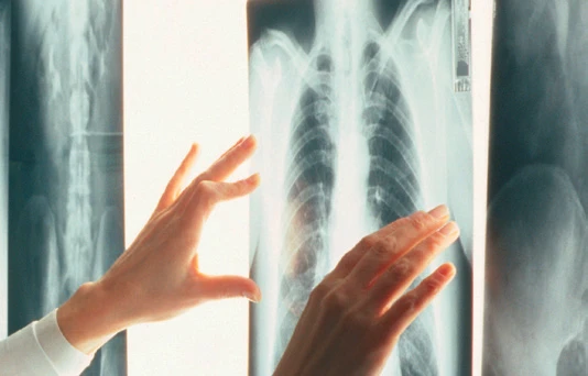 Термографическая пленка AGFA DT 5B размер 28x35см