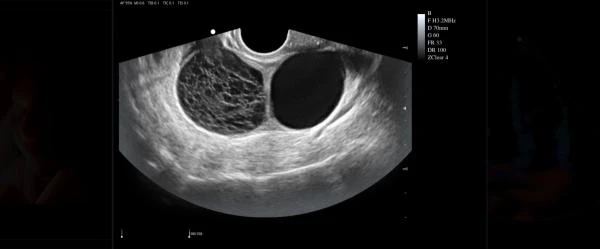 Ultrazvukovaya diagnosticheskaya oborudovanie ViV80