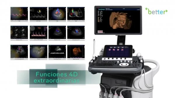 УЗИ аппараты Sonoscape