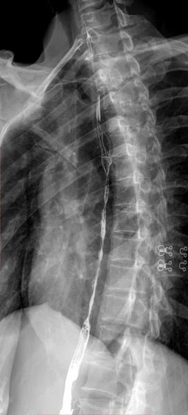 Sifrovoy rentgen apparat DR 6600 US-ARM