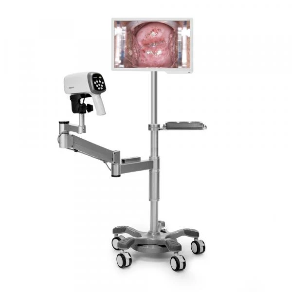 Videokolposkop EDAN C6A