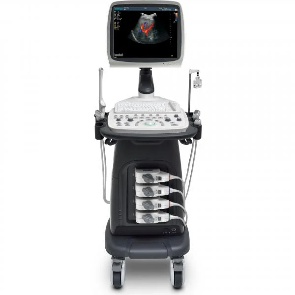 Ultratovush diagnostikasi tizimi S15