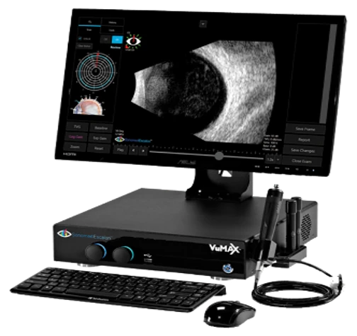 Ultrazvukovoy A/B-skan VuMax