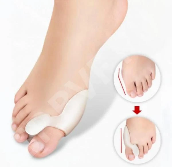 Medicus barmoq ushlagichi