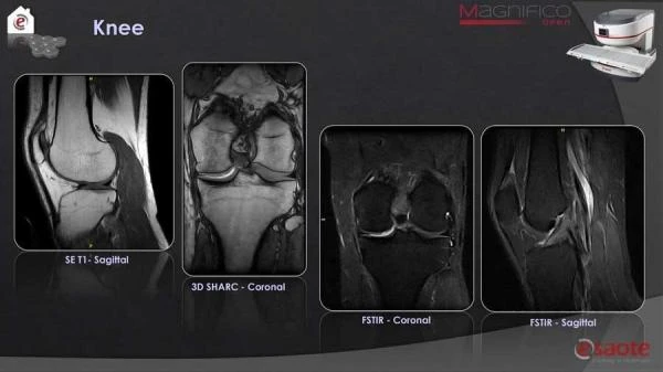 Magnifico yangi avlod MRI tizimi