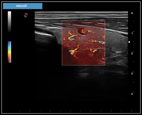УЗИ аппарат Esaote MyLab X7