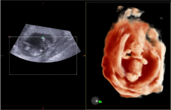 Esaote MyLab X5 ultratovush apparati