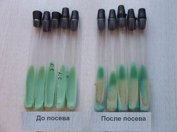 Микробиологический набор для транспортировки образцов с пит.средой