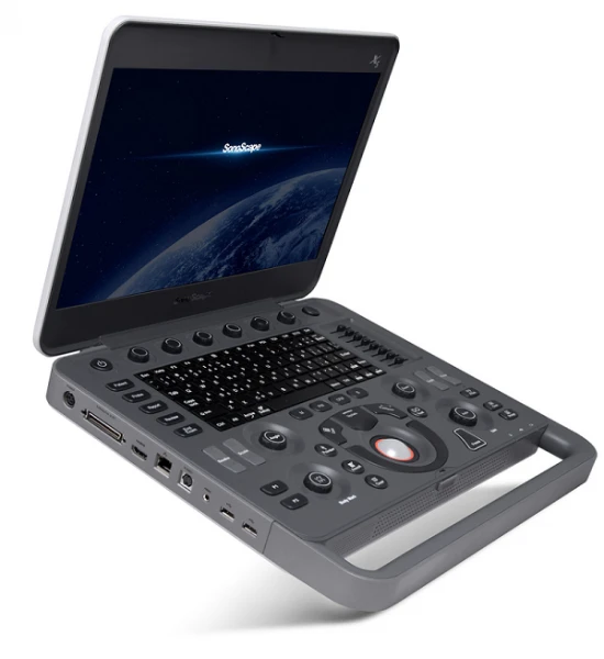 Система ультразвуковой диагностики Модель: SonoScape Х3