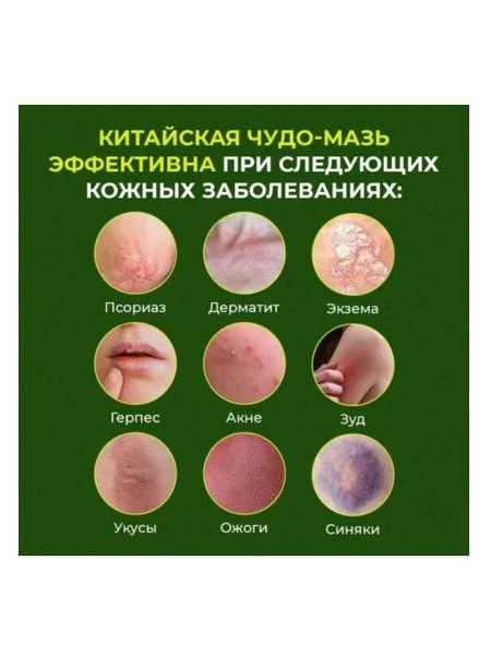 Крем от псориаз Psoriasis Cream 20g