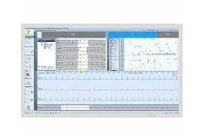 Xolterovskaya sistema Medilog Darwin ScanLab